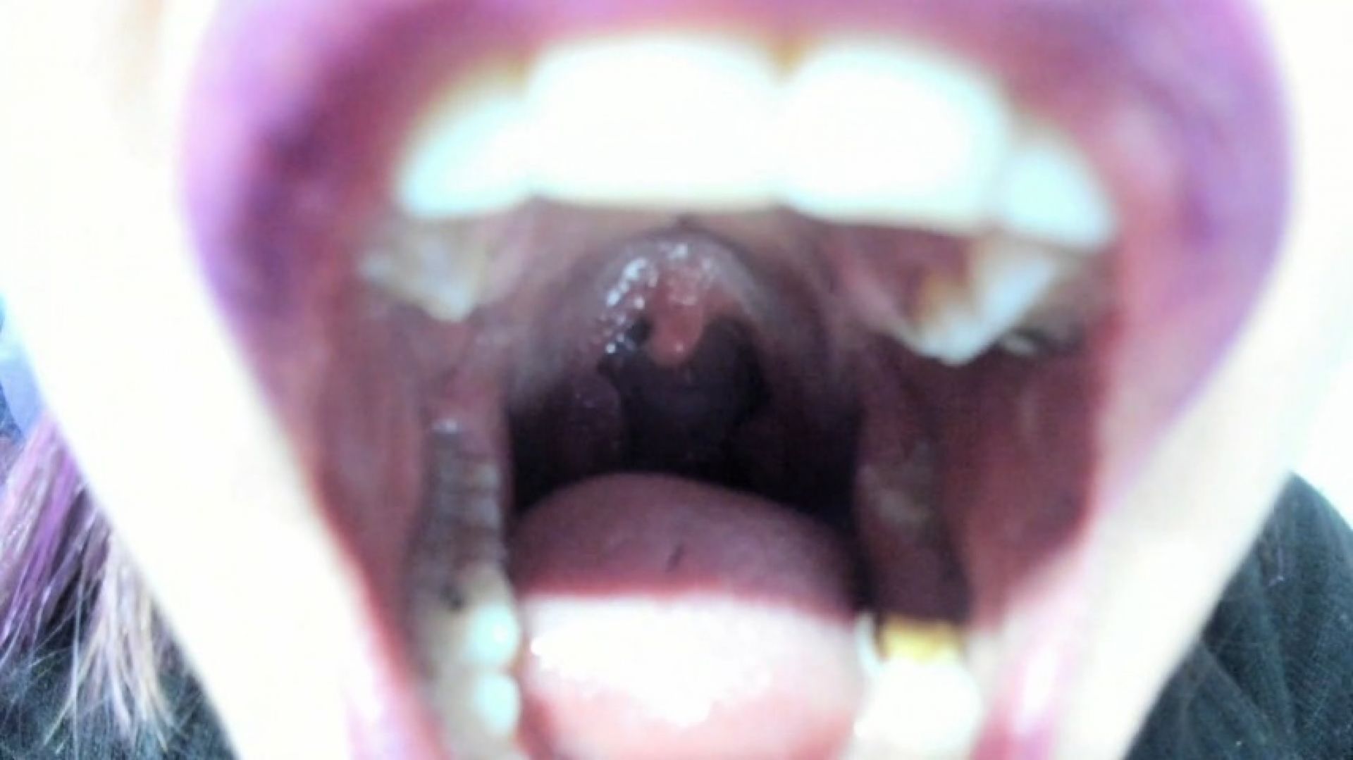 close up uvula