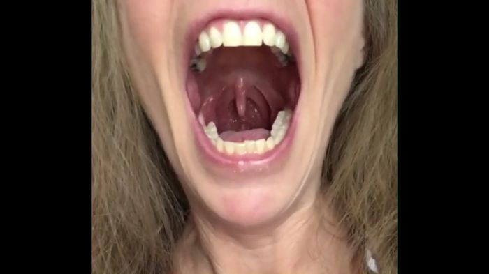 UVULA, UVULA, UVULA