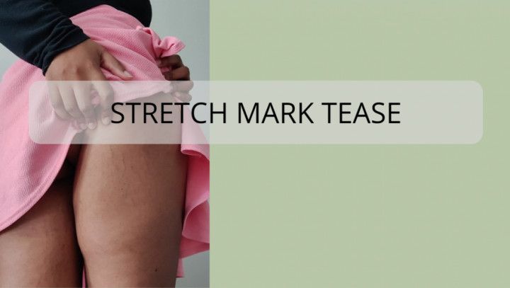 Stretchmark Tease