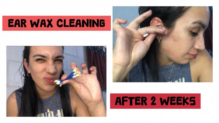 EAR WAX CLEANING AFTER 2 WEEKS