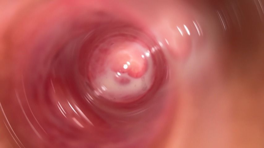 Inside teen Mia's pussy, internal camera