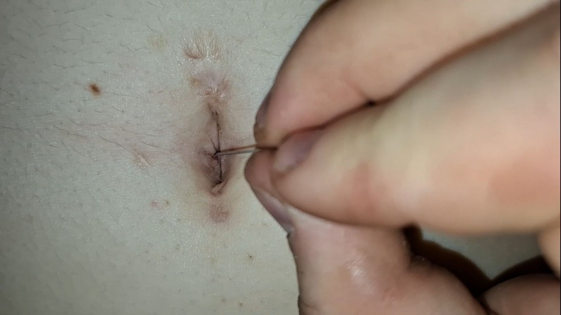 Teasing my belly button with a pin