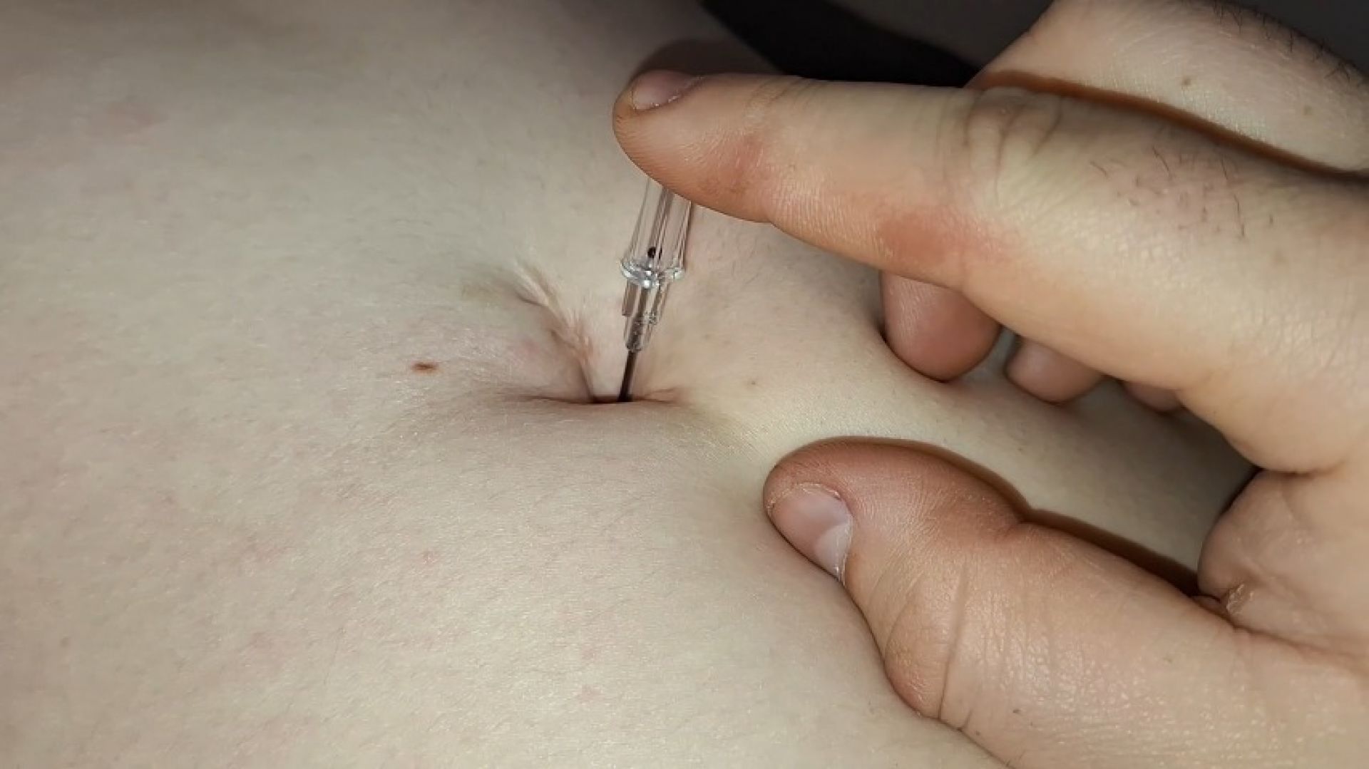 Thick needle in my belly button