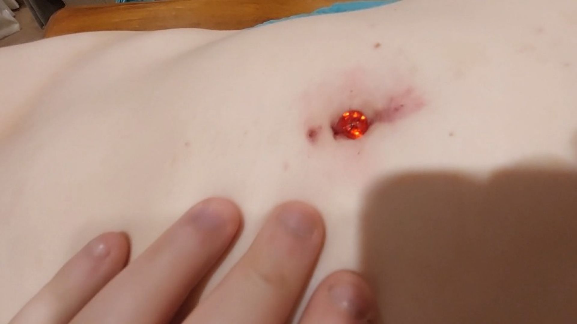 Big red jewel in my belly button