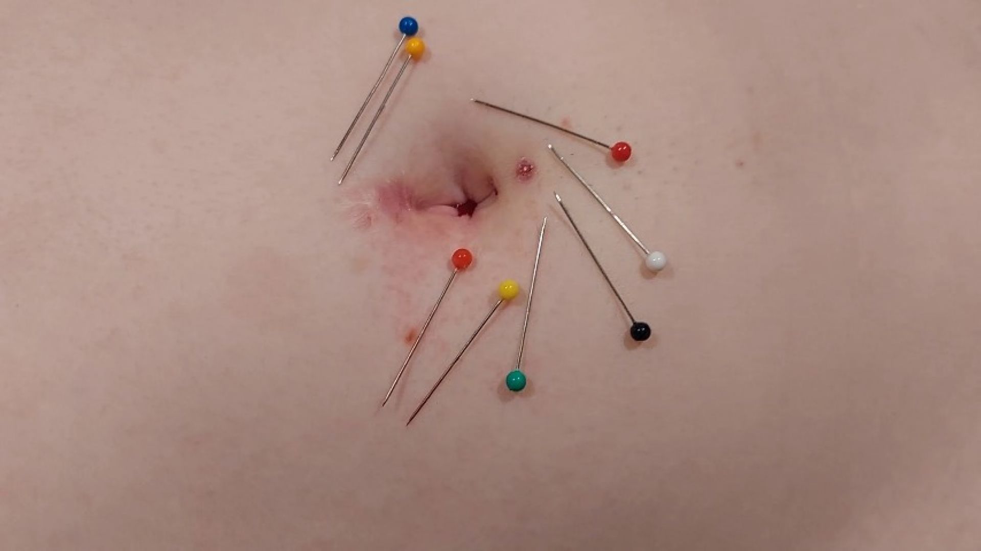 8 pins in my belly button