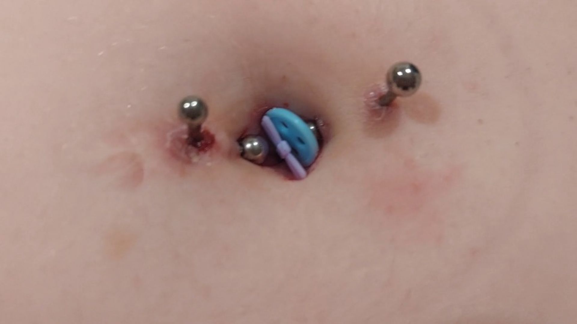 Decorative needles in my belly button