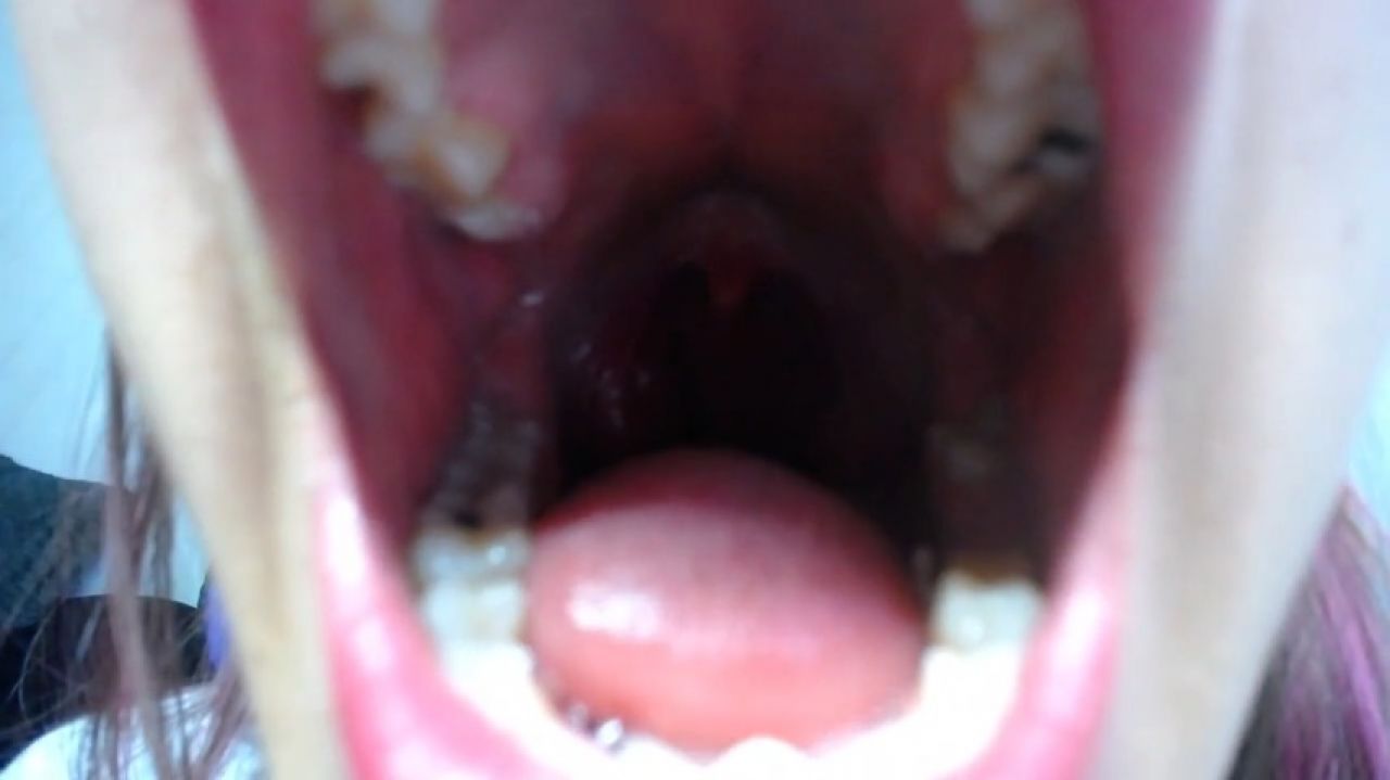 close big  burping show uvula