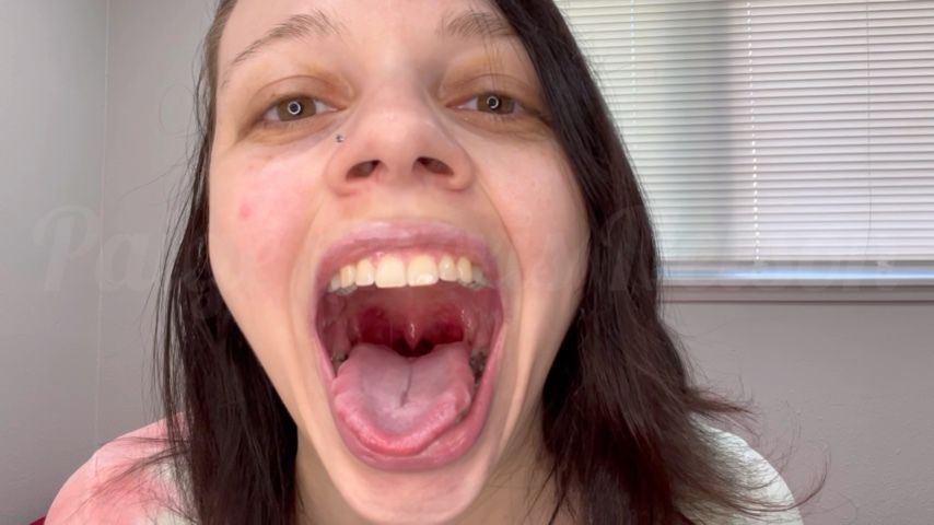 Up Close Tongue and Uvula