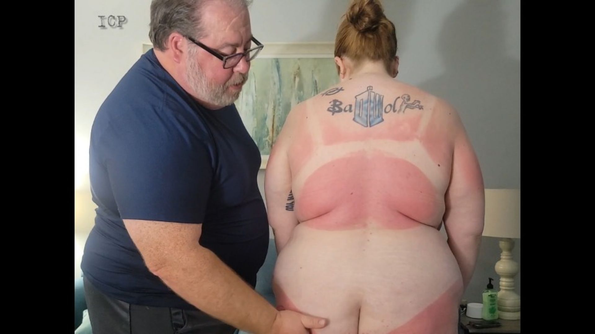 Bunny Sweetlove Sunburn BDSM