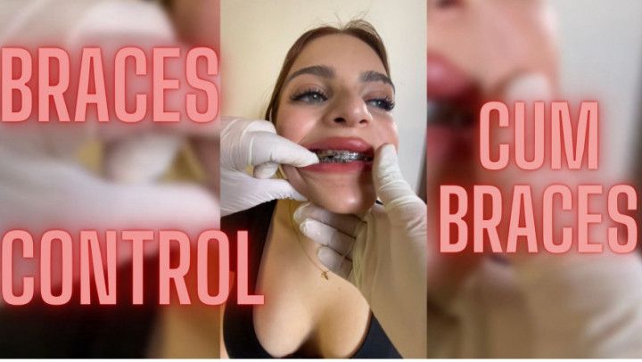 FETISH - Checking dental braces ends with semen on teeth