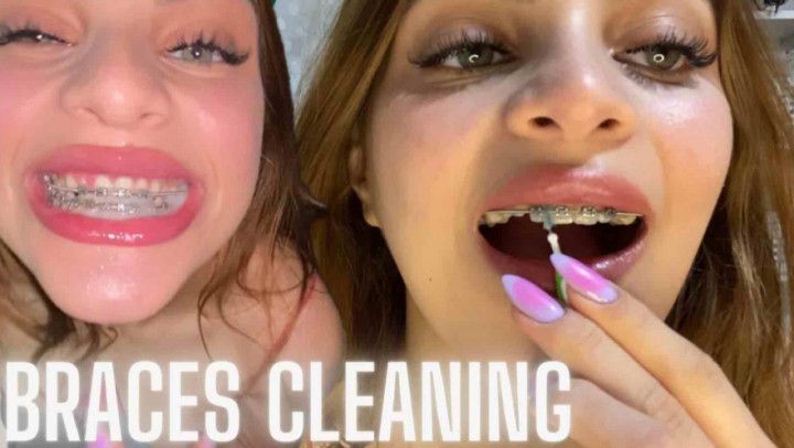 FETISH - BRACES CLEANING WITH AWARD - DENTAL