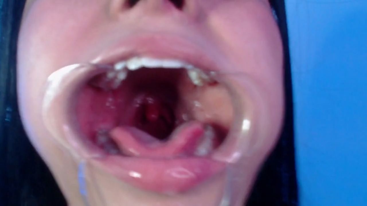 uvula play and open throat