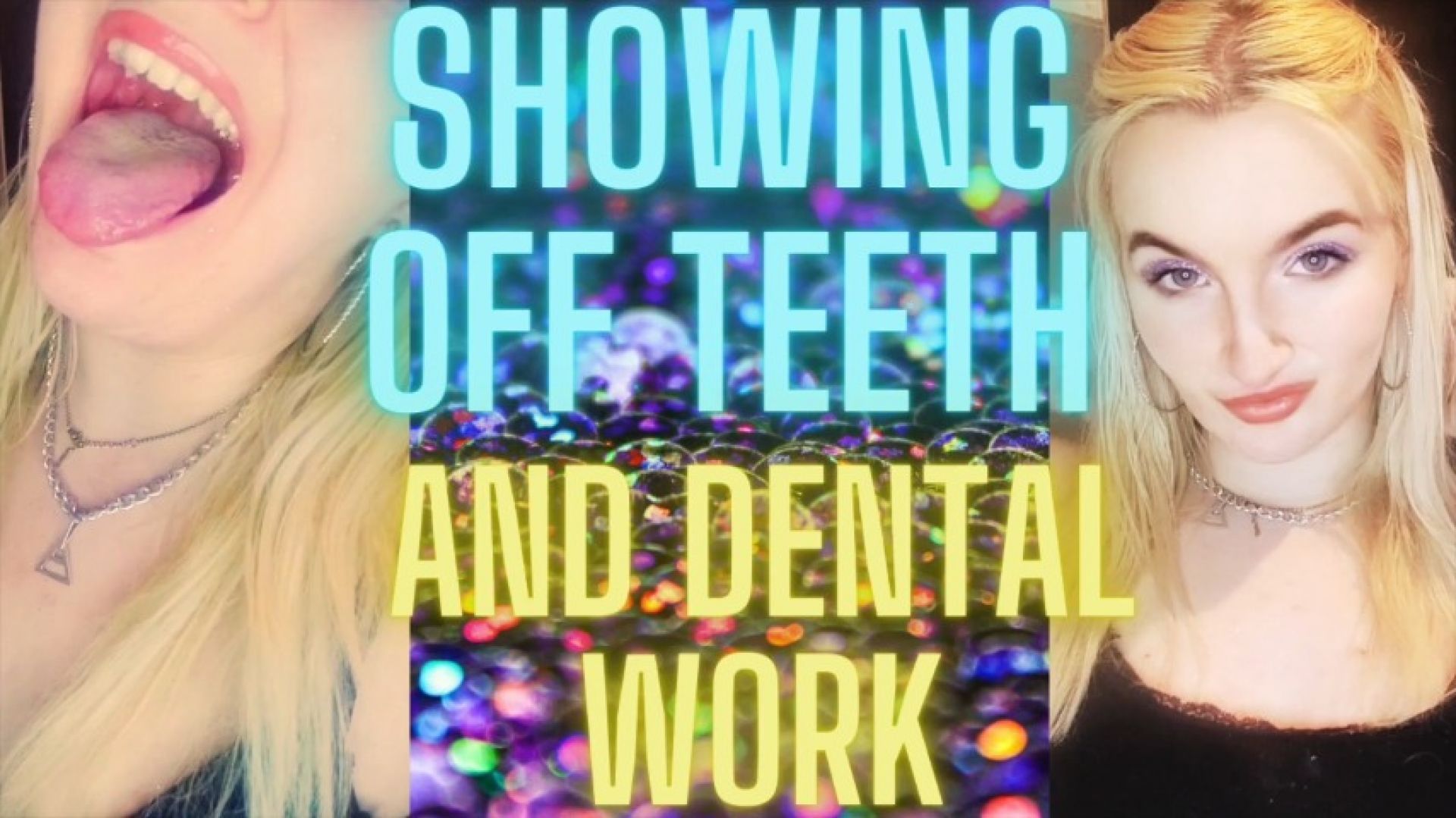 10) SHOWING OFF TEETH AND DENTAL WORK