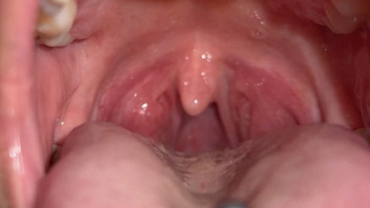 Close up of my monster tongue and uvula