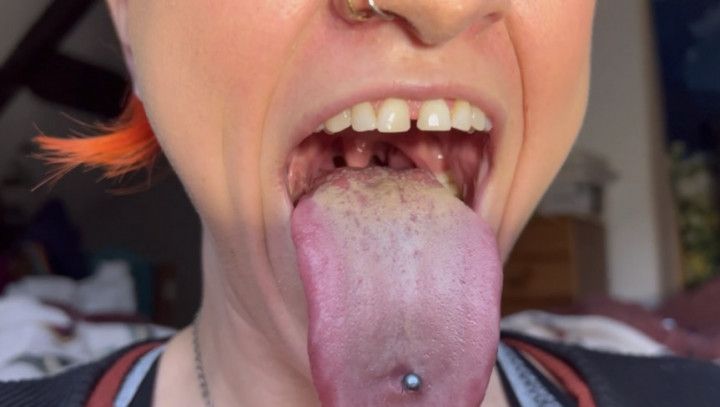 White dirty tongue bad breath uvula