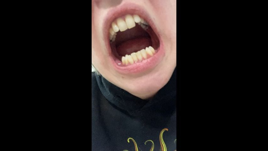 Mouth Delight: Closeups of Sexy Teeth for Mouth Fetishists