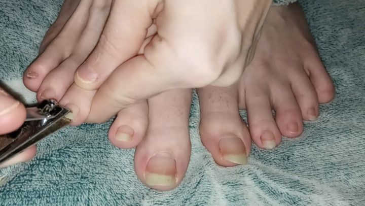 Extremely Long Toenail Clipping 01-17-23