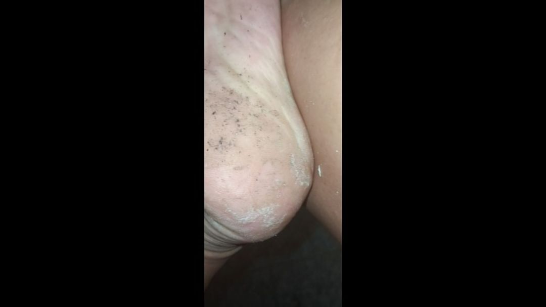 Watch me peel off my Dry Dirty Feet