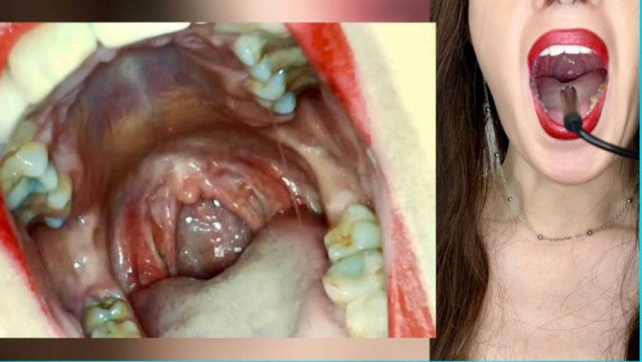 Endoscopic journey through my mouth