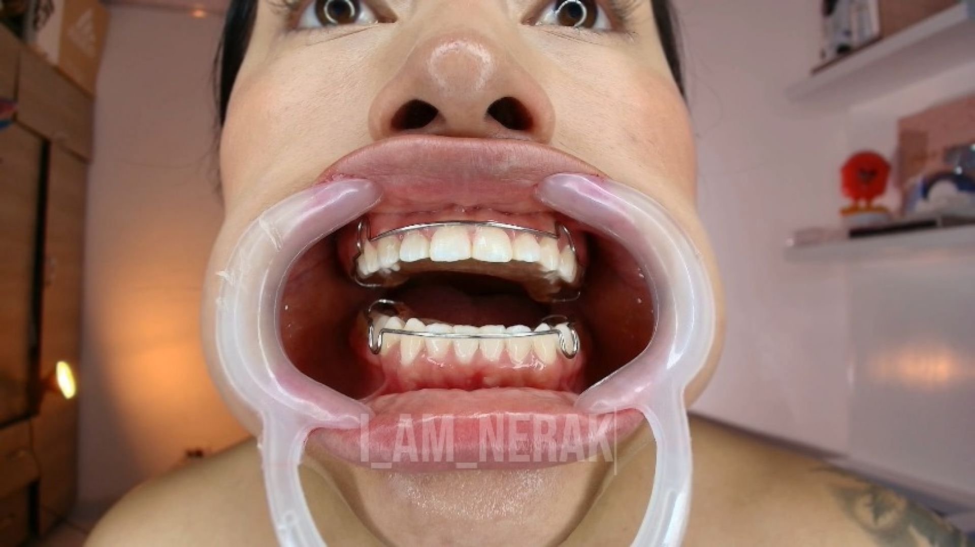 RETAINER AND MOUTH EXPANDER