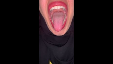 My tongue