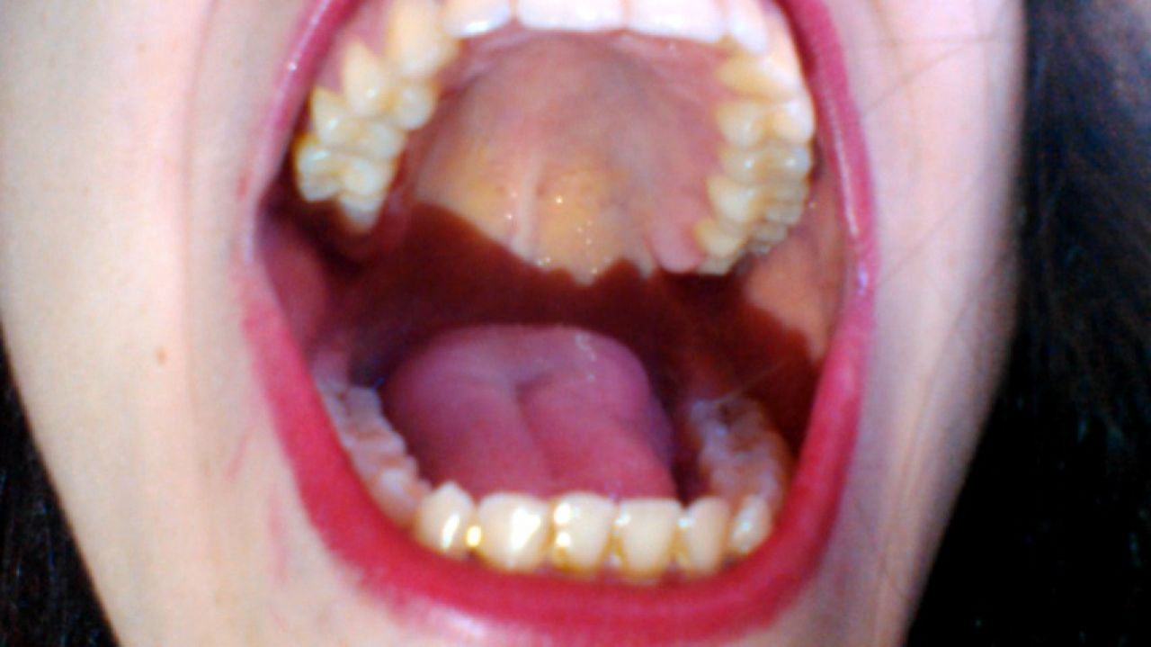 My mouth and my teeth