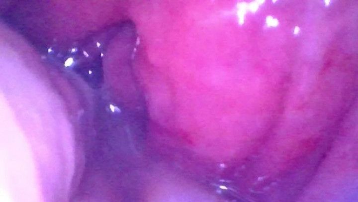 Endoscope inside POV of my juicy Ass getting fisted deeply