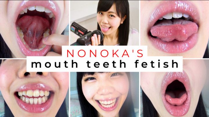 Dental Selfies with Naughty Nonoka OZAKI