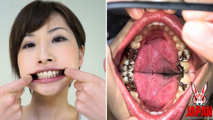 Teeth Inspection Chronicles: Dive into Yua Hidaka's