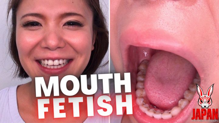 Teeth Examination: Beauty Unveiled