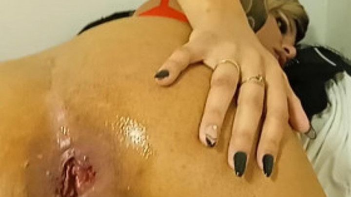 See inside my asshole! Wide gape from anal fisting! Real