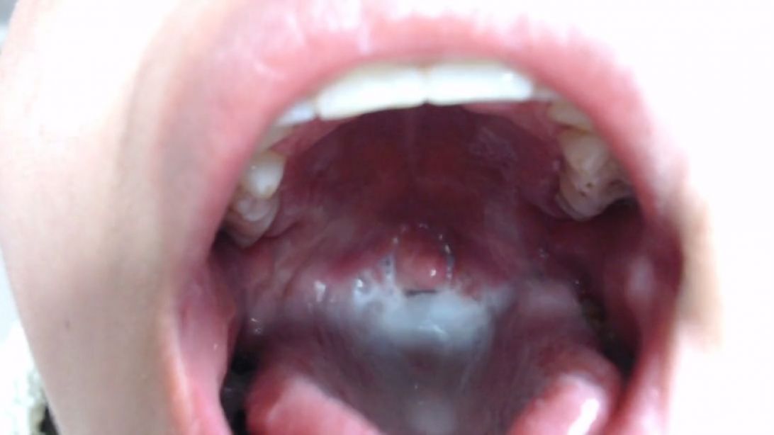 show close my uvula with milk