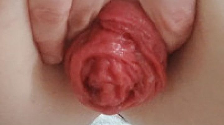 Growing my prolapse and an huge orgasm