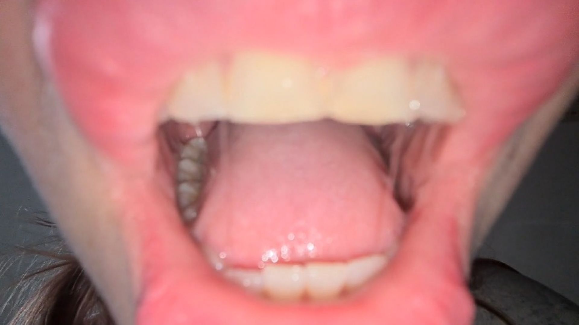 Inside Chloe's mouth