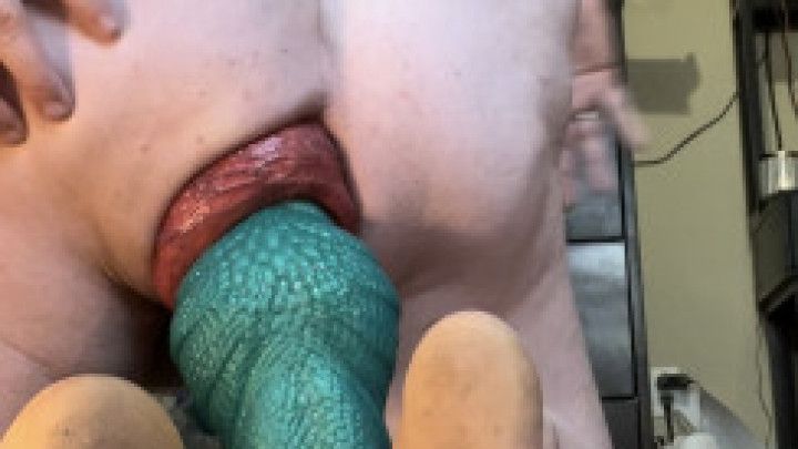 Dildo in my Prolapse