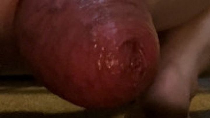 Prolapsing my anal hole