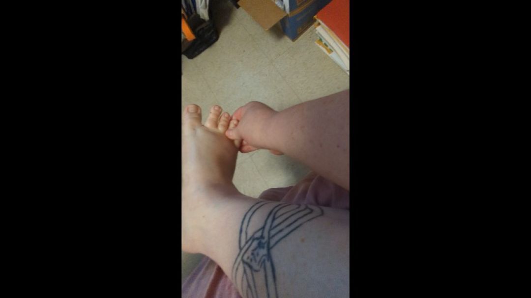 BBW right foot treatment