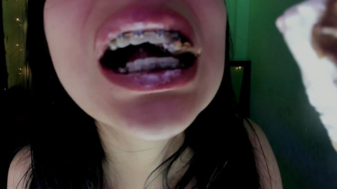 dirtying my braces with cocolate ice cream