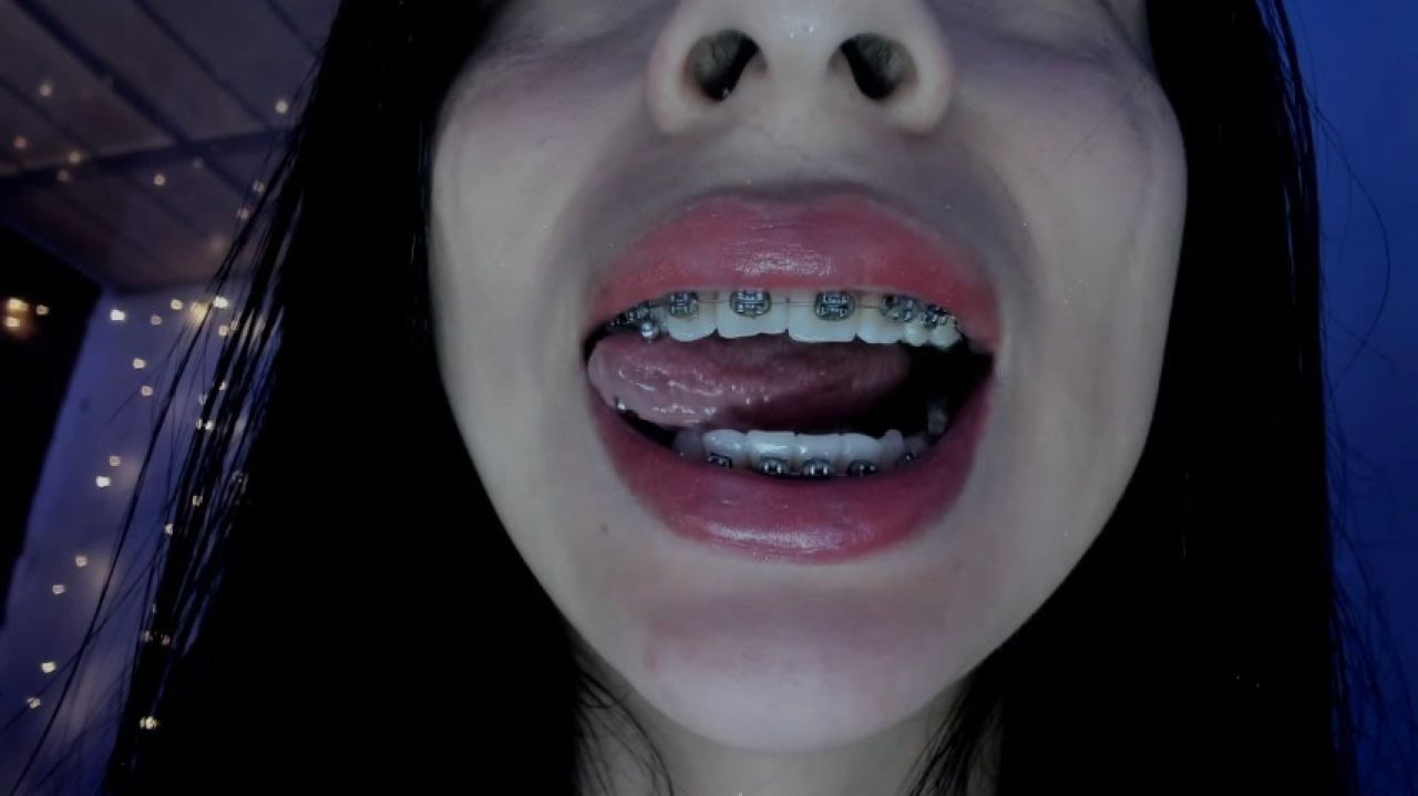 Playing with my Braces