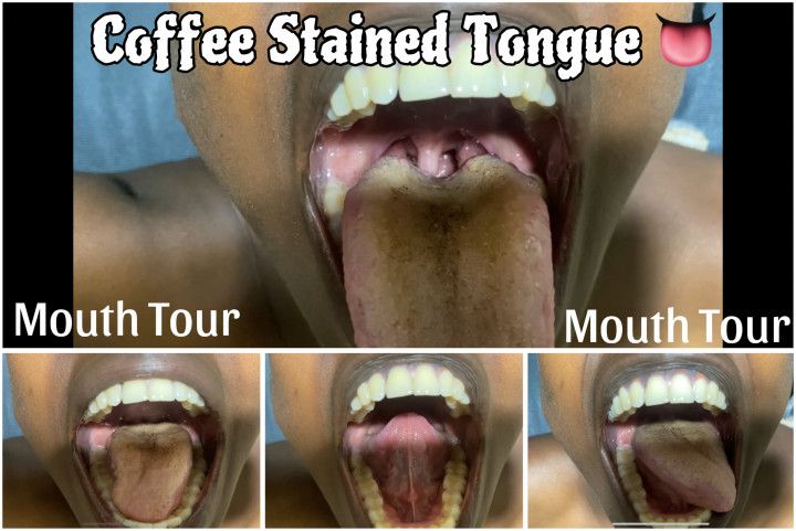 Coffee Stained Tongue Mouth Tour