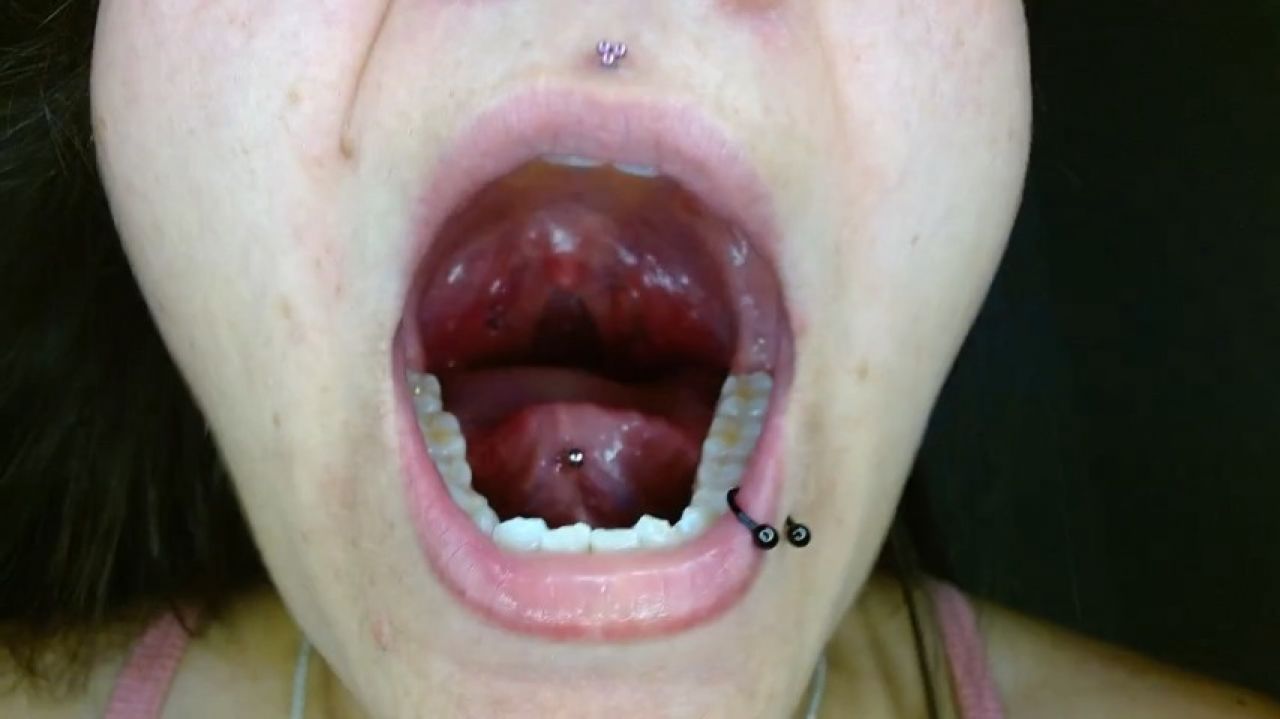 play spit and show uvula