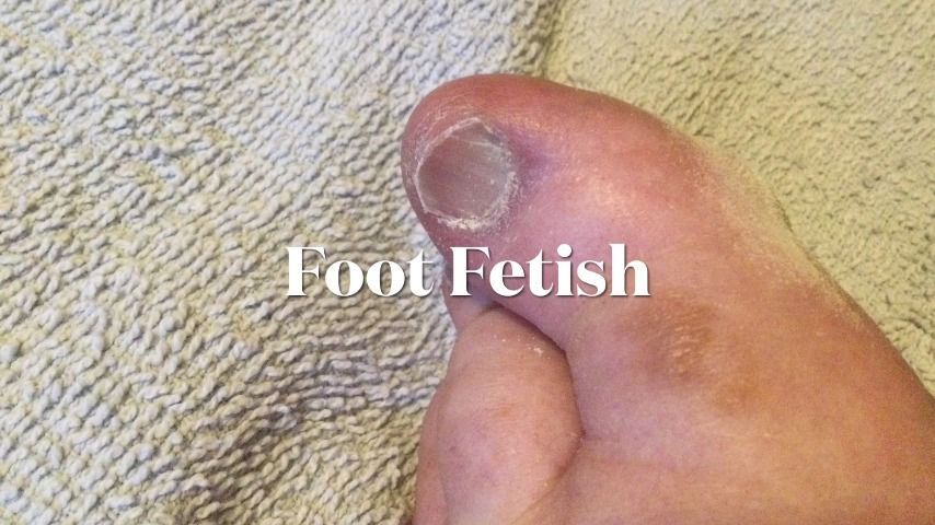 MrAlSouth – MV0135 Foot Fetish – Callus