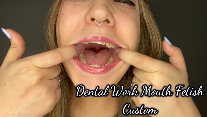 Dental Work Mouth Fetish Custom