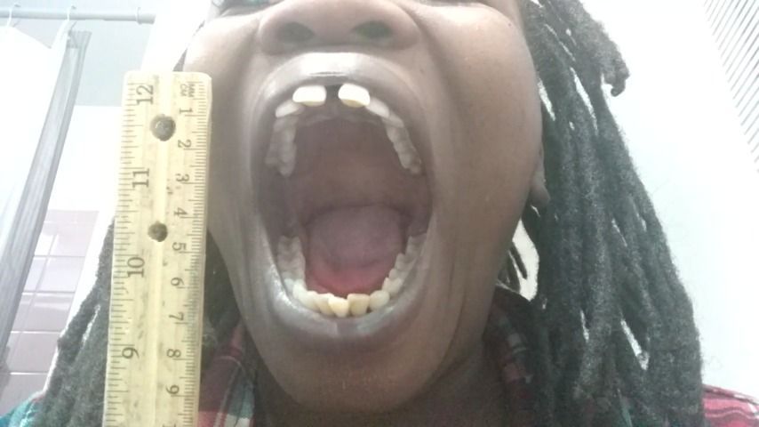 Measure my Mouth