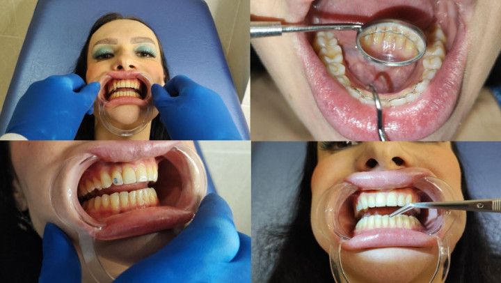 Complete teeth exam by the dentist, installation of jewelry