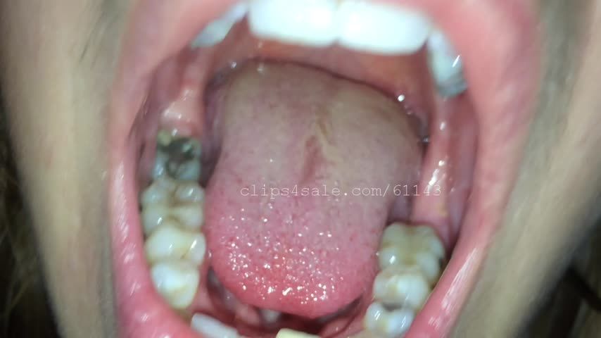 Casey Mouth Part2 Video1