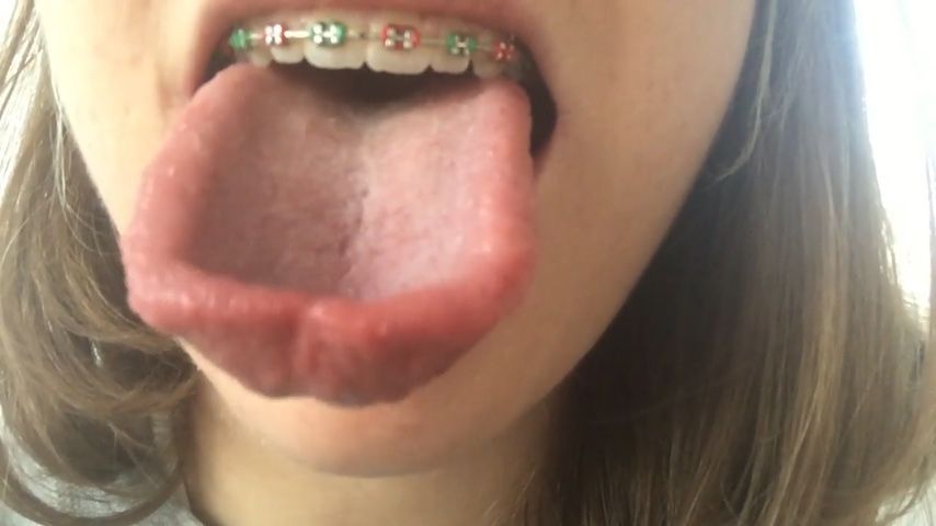 Tongue, Braces, Mouth, Close Up