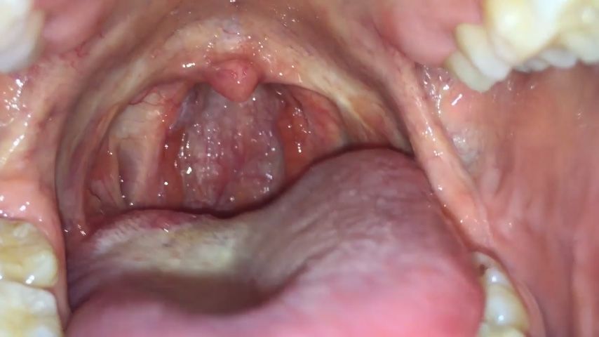 A tour into the inside of my mouth