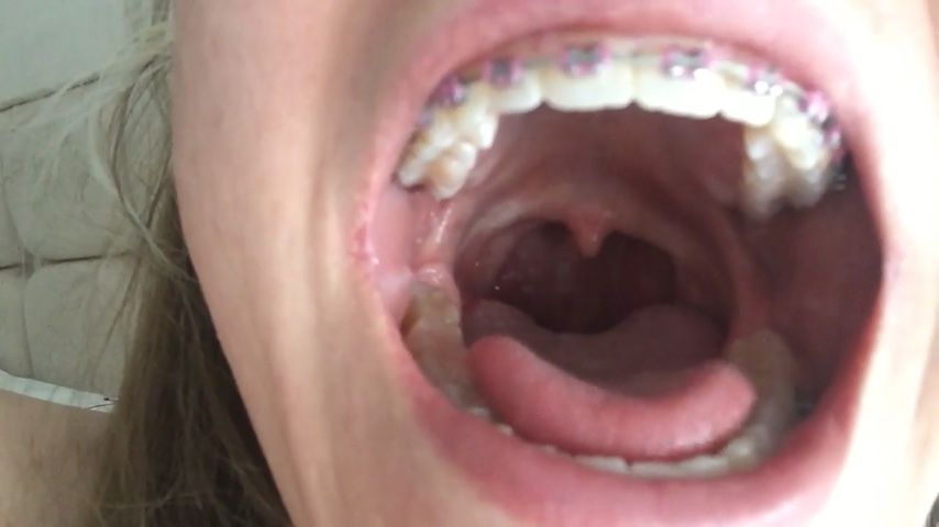 The dirtiest mouth