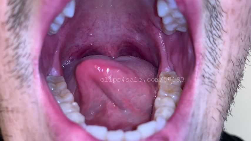 Cody Lakeview Mouth Video 1